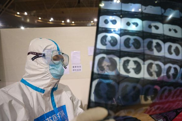 /image/2020/08/07/crop-12_11_393x593_china-health-virus.jpg