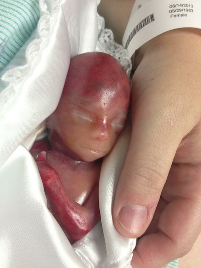 Сперматозоидтар порносы бар әйелмен жыныстық қатынас