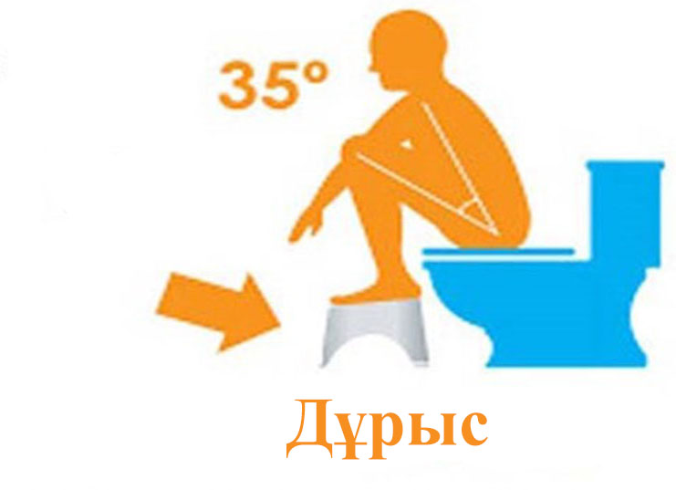 Сыртқа ағып жатқан сперматозоидтар