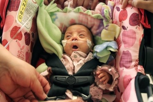 Шала туған сәби