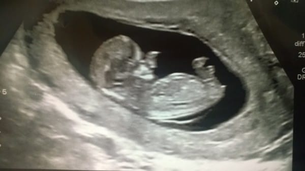 Іш киімсіз әдемі әйелдердің суреттері