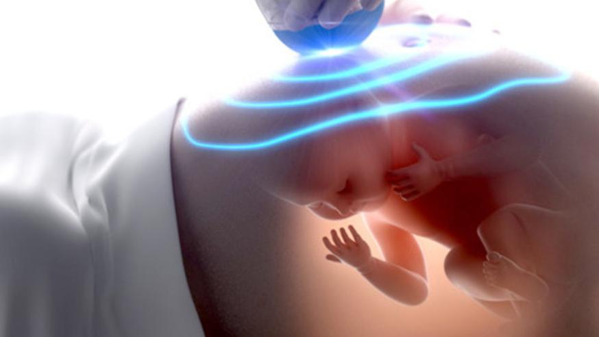 Тығыз волосатые письки порно видео